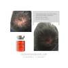 CALECIM Professional Advanced Hair System 6 x 5ml + Stempel