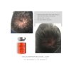CALECIM Professional Advanced Hair System 6 x 5ml