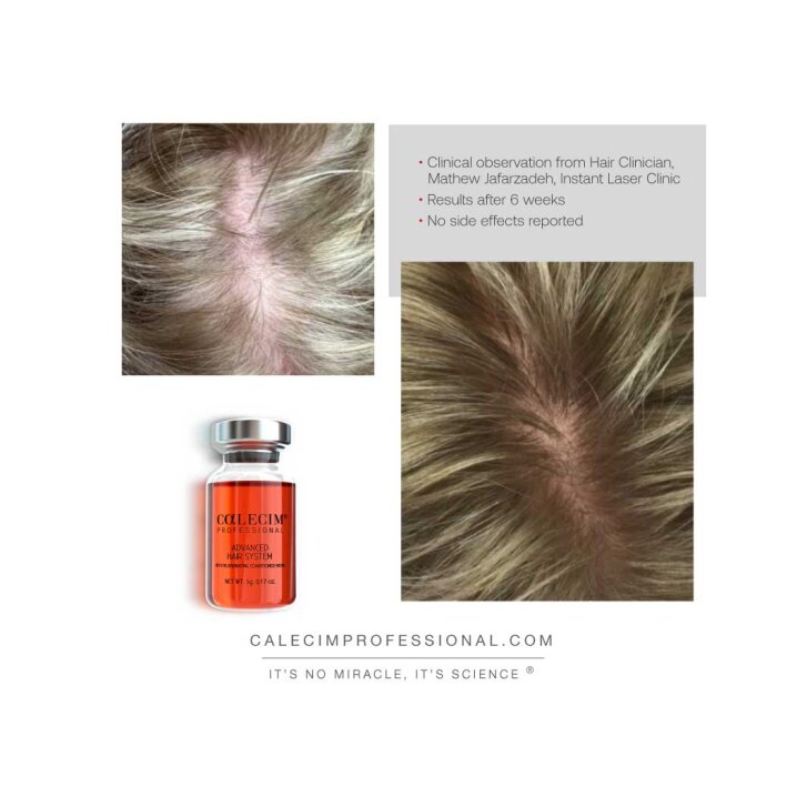 CALECIM Professional Advanced Hair Ampulle 1x5ml