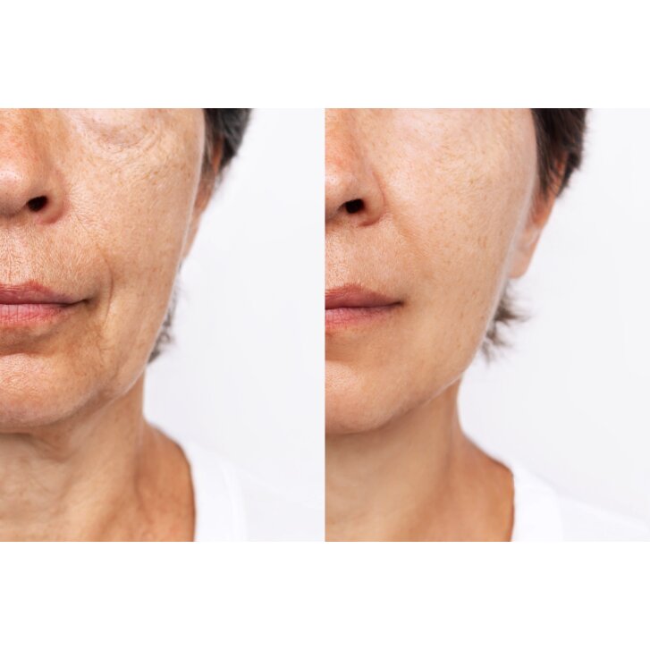 CALECIM Professional Serum 6x5ml