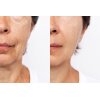 CALECIM Professional Serum 6x5ml